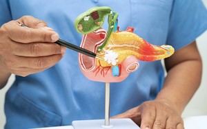 Avance en cáncer de páncreas: logran hacer más permeable la célula tumoral para mejorar la quimioterapia